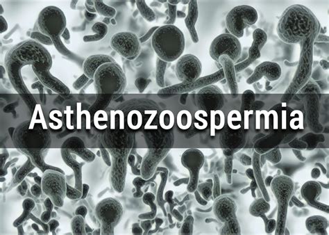 What is asthenozoospermia? - Causes, Effects, Diagnosis & Treatment