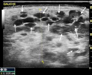 Clinical Ultrasound of the Salivary Glands | Ento Key