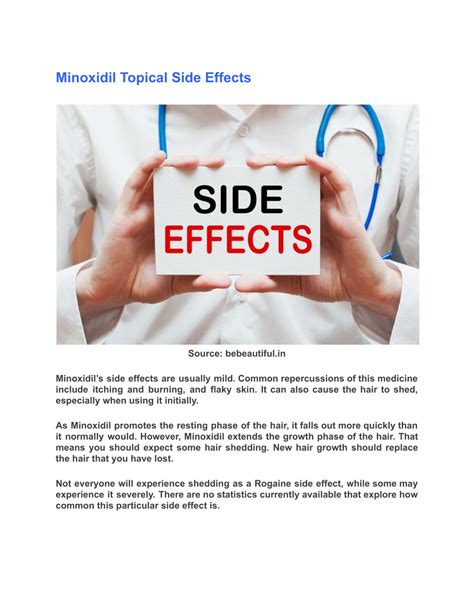 PPT - Minoxidil Side Effects and How to Use It PowerPoint Presentation ...