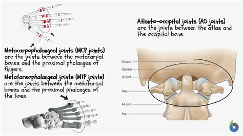 Condyloid Joint