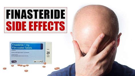 Worried About Finasteride Side Effects? Read This First!