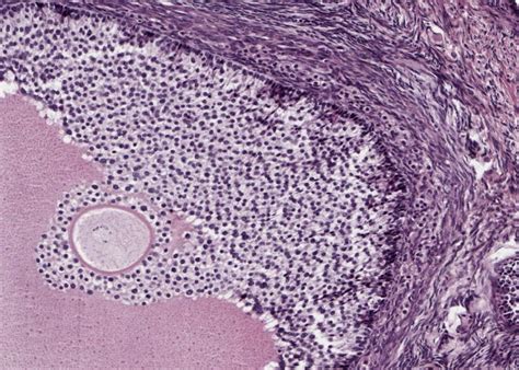 Female Reproductive System – Meyers Histology