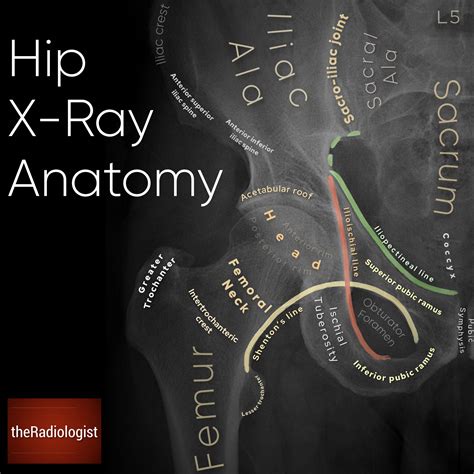 Labeled Hip X-Ray Anatomy By Naveen Sharma TheRadiologist , 43% OFF