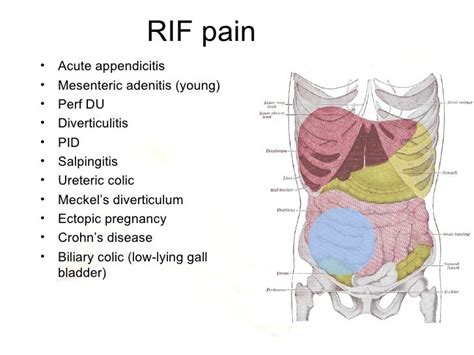 Diagnosis And Management Of Acute Abdominal Pain