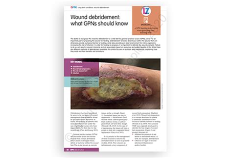 Wound debridement: what GPNs should know - Journal of General Practice ...