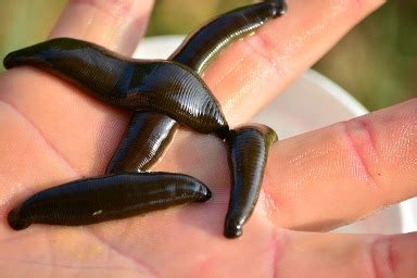 The Benefits of Leech Therapy in Wound Care | WoundSource