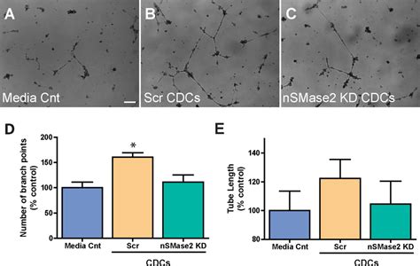 hCDC exosomes stimulate angiogenesis in a HUVEC angiogenesis ...