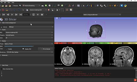 An Introduction to 3D Slicer. A brief overview of an open source… | by ...