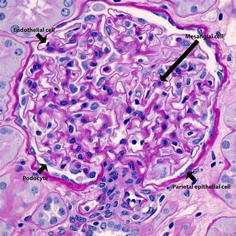 Glomerular Basement Membrane Histology