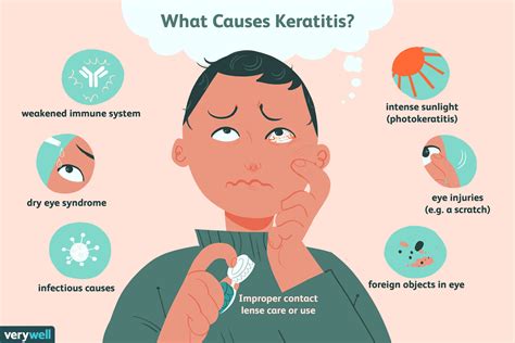 Keratitis: Its Causes, Symptoms, and How It's Treated