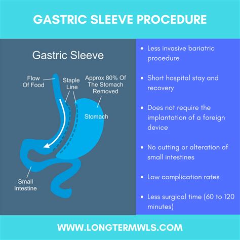 Long Term WLS / VSG | Gastric Sleeve Surgery - Dr. Jorge Maytorena ...