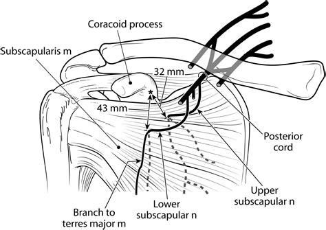 Relationship of the Subscapular Nerves to the Base of the Coracoid ...