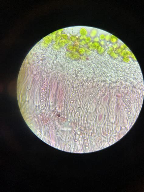 Apothecia cross-section under microscope. Thought y’all would enjoy ...