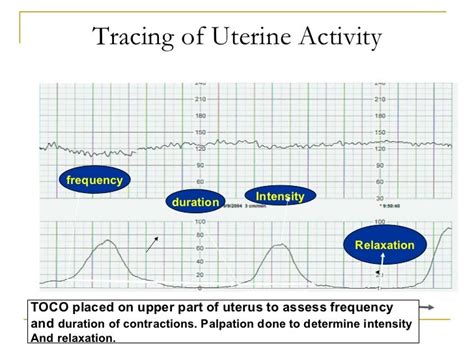 Wiki.assessment of uterine contractions 2011