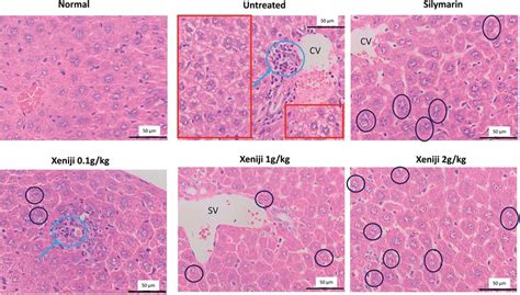 Histopathology of the liver from normal mice, and untreated and ...