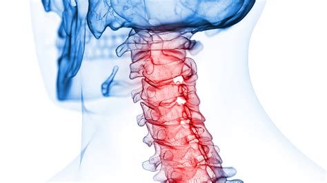 Cervical Laminoplasty vs Laminectomy: What's the Difference?