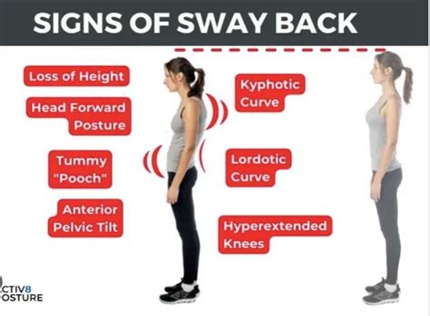 How to fix sway back Posture | Fitness - Blind