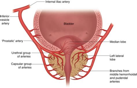 Transrectal Ultrasound of the Prostate | Radiology Key