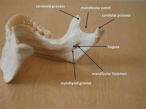 Anatomy of the mandible: mandibular notch, condylar process, lingula ...