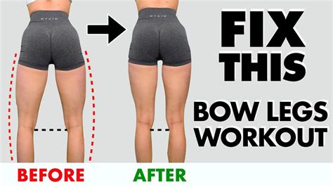 10 Min "Bow Legs" Home Workout | FIX Bow Legs in 10 Min/Day! - YouTube