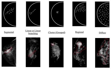 Diagnostics | Free Full-Text | End-to-End Calcification Distribution ...