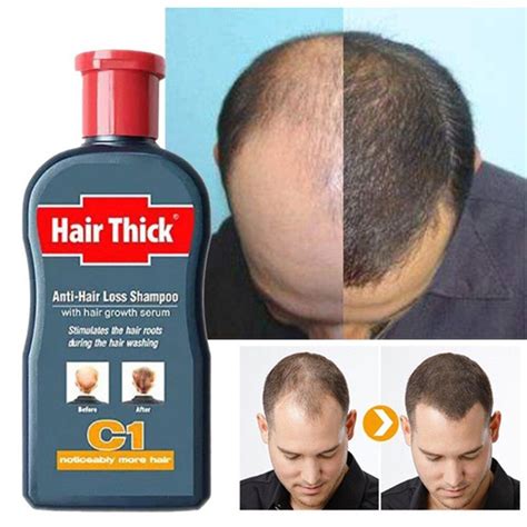 Best Product For Hair Growth Fast For Mens