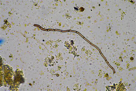 soil microbes organisms in a soil and compost sample, fungus and fungi ...