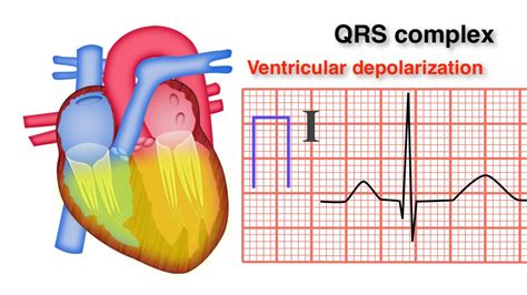 How To Measure Qrs Complex On An Ecg