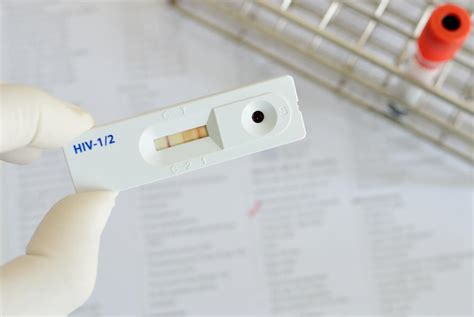 False Negative Elisa Hiv Falsepositive Hiv Test Go