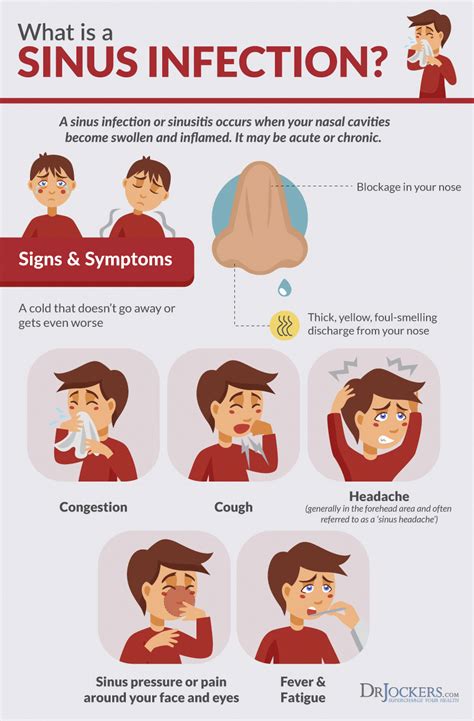 Top 8 Sinus Infection Natural Remedies - DrJockers.com # ...