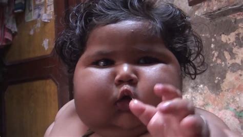 Morbidly obese baby leaves doctors baffled tipping the scales at nearly ...