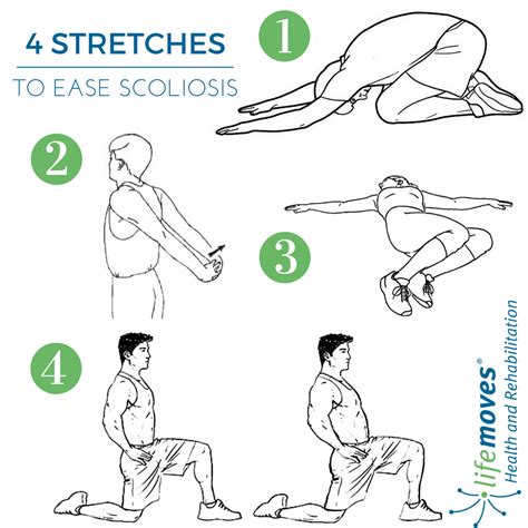 4 Stretches for Scoliosis | Yoga for scoliosis, Scoliosis, Stretches ...