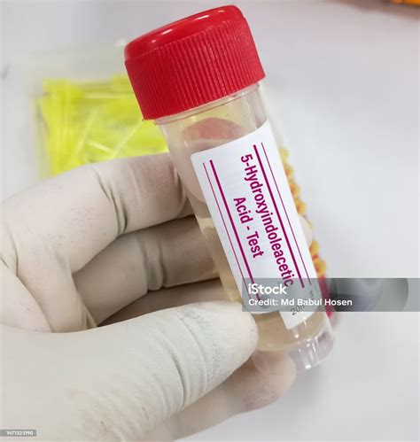 Urine Sample For 5hiaa Test Stock Photo - Download Image Now - iStock