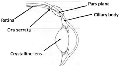 Anatomical illustration of the pars plana | Download Scientific Diagram