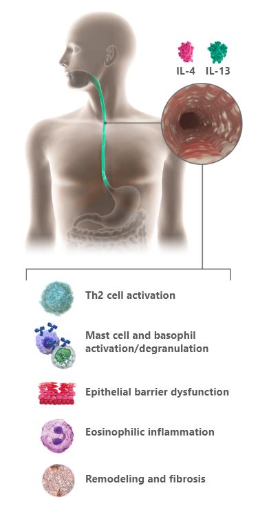 Mechanism of Action in EoE | DUPIXENT® (dupilumab)