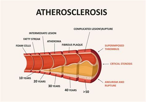 Guide to Ocular Ischemic Syndrome (& Treatment) | NVISION Eye Centers