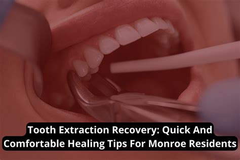 Tooth Extraction Recovery: Quick And Comfortable Healing Tips For ...