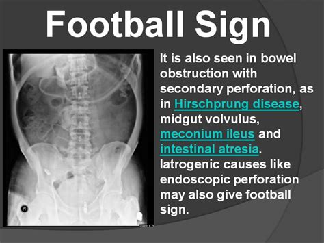 FOOTBALL SIGN - Radiology Classroom