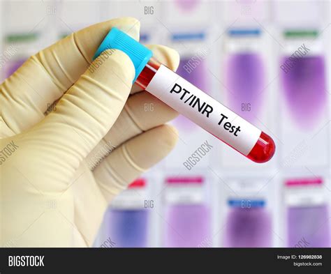 Test tube with blood sample for PT/INR test, blood coagulation testing ...