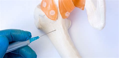 What is the function of bone marrow? How are bone marrow tests done?