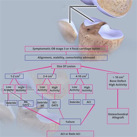 Chondral Defect of the Knee - Rajesh Bhalla