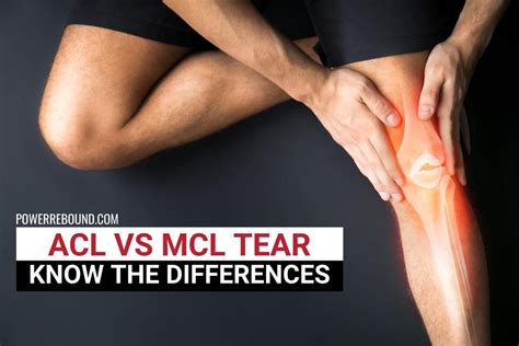 ACL vs MCL Tear: Know the Differences | Dolor en la rodilla, Remedios ...