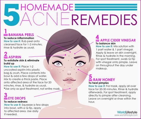 5 DIY Acne Remedies - WorldLifestyle | Acne remedies, Acne cure ...