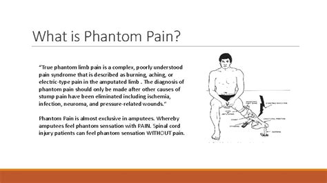 Phantom SensationPain BY JOSIP SULENTIC Pain theory Phantom