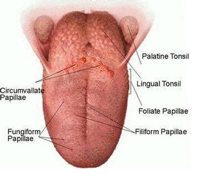 Inflamed Taste Bud - Pictures, Causes, Treatment, Home Remedies