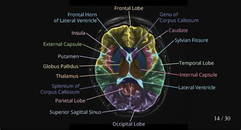 Mri Brain Anatomy