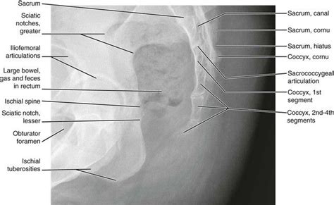 Normal Anatomy | Body anatomy, Anatomy, Radiology