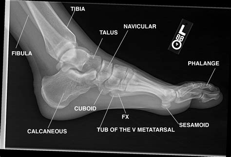 Pin by circus___fluffy___ on Bones | Foot anatomy, Medical anatomy, Anatomy