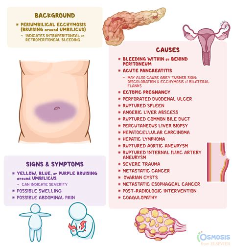 Ecchymosis Vs Bruise