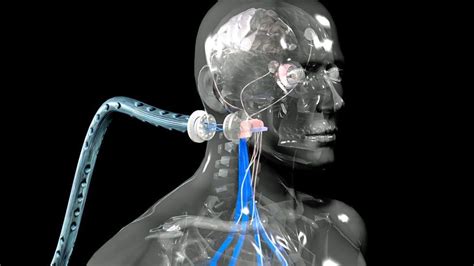 Beyond human: How I became a cyborg - BBC Future